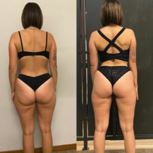2pt prima dopo