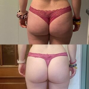 prima dopo clienti sibilla gazzani 1