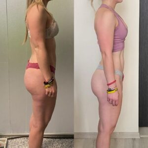 prima dopo clienti sibilla gazzani 2