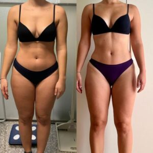 prima dopo clienti sibilla gazzani 3