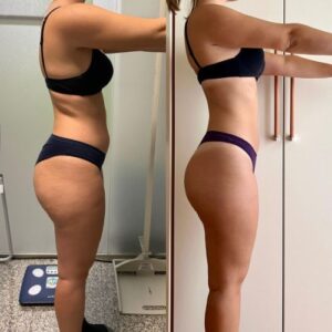 prima dopo clienti sibilla gazzani 4