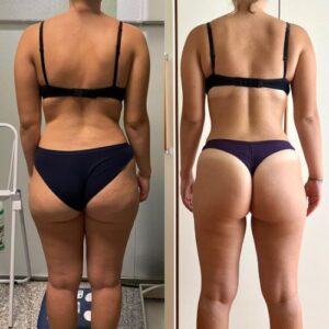 prima dopo clienti sibilla gazzani 5