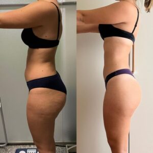 prima dopo clienti sibilla gazzani 6