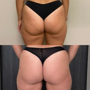 prima dopo clienti sibilla gazzani 8